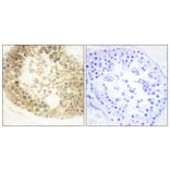Immunohistochemistry - Anti-ECRG4 Antibody (C11679) - Antibodies.com