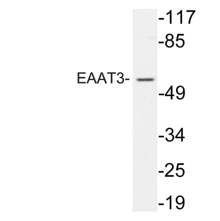 Western Blot - Anti-EAAT3 Antibody (R12-2122) - Antibodies.com