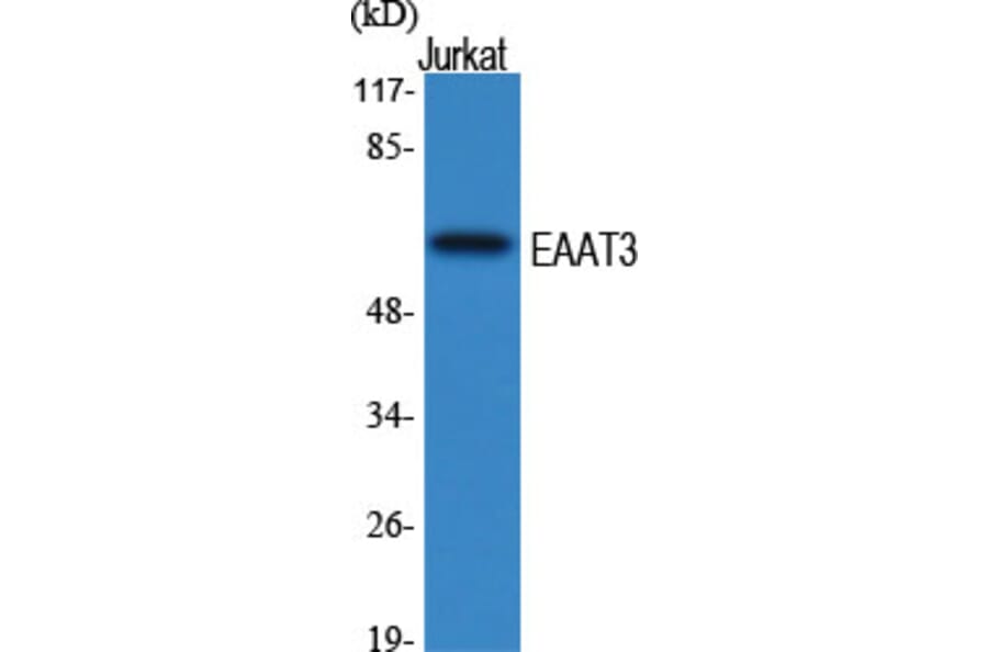 Western Blot - Anti-EAAT3 Antibody (R12-2122) - Antibodies.com