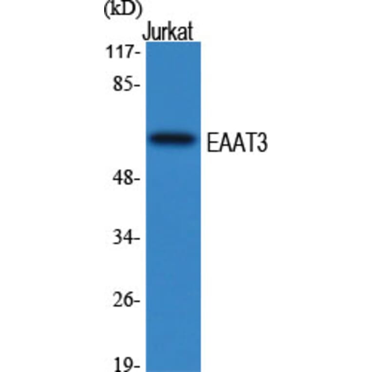 Western Blot - Anti-EAAT3 Antibody (R12-2122) - Antibodies.com