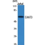 Western Blot - Anti-EAAT3 Antibody (R12-2122) - Antibodies.com