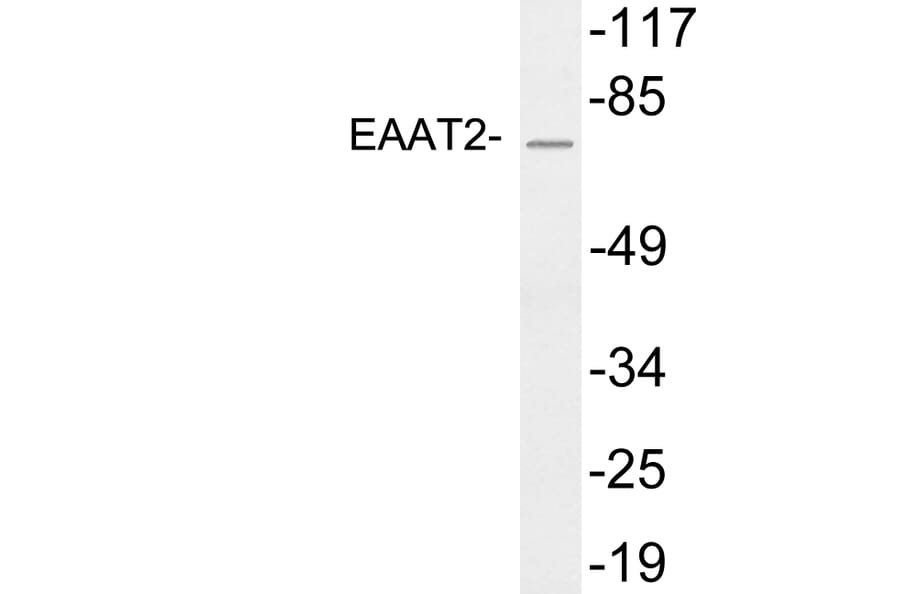 Western Blot - Anti-EAAT2 Antibody (R12-2121) - Antibodies.com