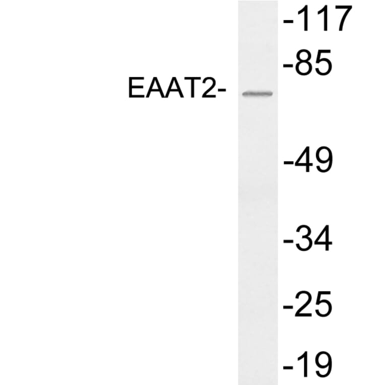 Western Blot - Anti-EAAT2 Antibody (R12-2121) - Antibodies.com