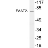 Western Blot - Anti-EAAT2 Antibody (R12-2121) - Antibodies.com