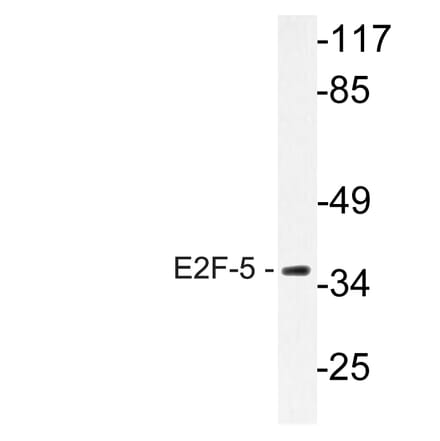 Western Blot - Anti-E2F-5 Antibody (R12-2119) - Antibodies.com