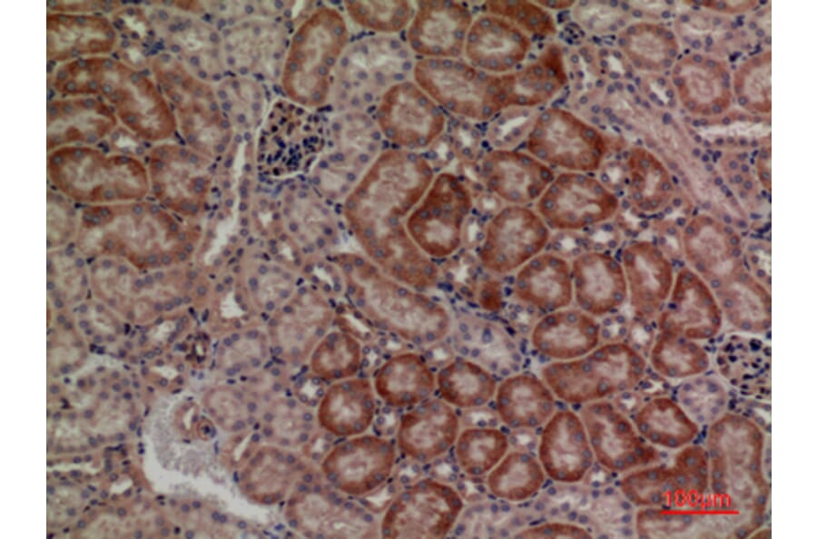 Immunohistochemistry - Anti-DUSP3 Antibody (C30285) - Antibodies.com
