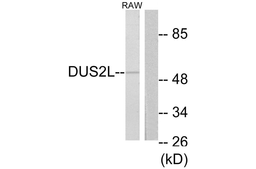 Western Blot - Anti-DUS2L Antibody (C11772) - Antibodies.com