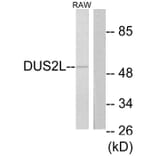 Western Blot - Anti-DUS2L Antibody (C11772) - Antibodies.com