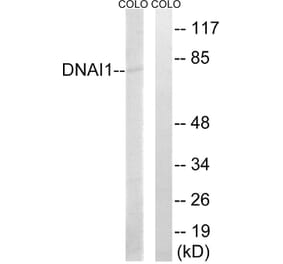 Western Blot - Anti-DNAI1 Antibody (C15510) - Antibodies.com