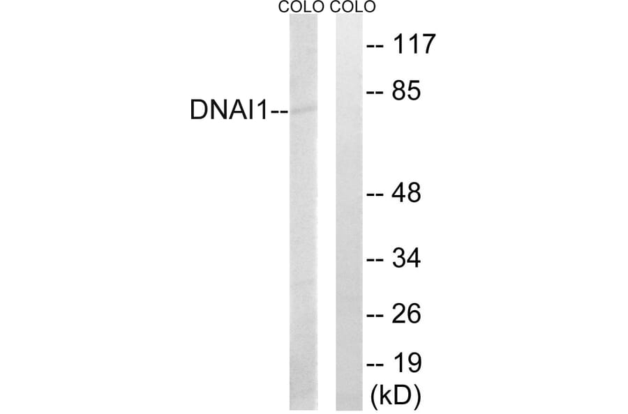 Western Blot - Anti-DNAI1 Antibody (C15510) - Antibodies.com