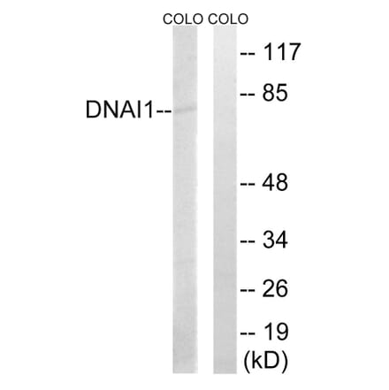 Western Blot - Anti-DNAI1 Antibody (C15510) - Antibodies.com