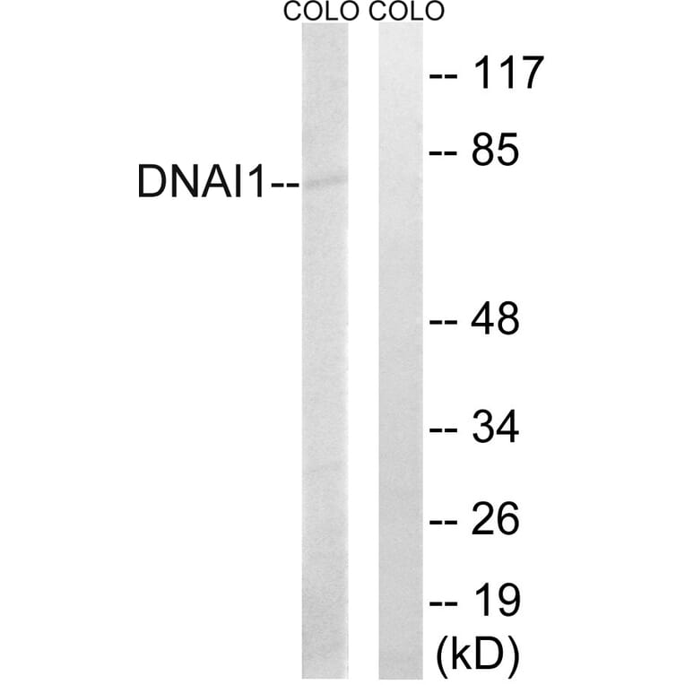 Western Blot - Anti-DNAI1 Antibody (C15510) - Antibodies.com
