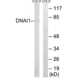 Western Blot - Anti-DNAI1 Antibody (C15510) - Antibodies.com