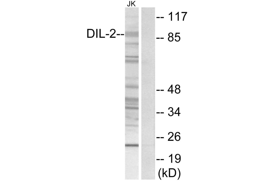 Western Blot - Anti-DIL-2 Antibody (C11884) - Antibodies.com