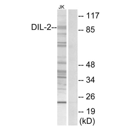 Western Blot - Anti-DIL-2 Antibody (C11884) - Antibodies.com