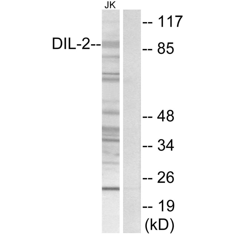 Western Blot - Anti-DIL-2 Antibody (C11884) - Antibodies.com