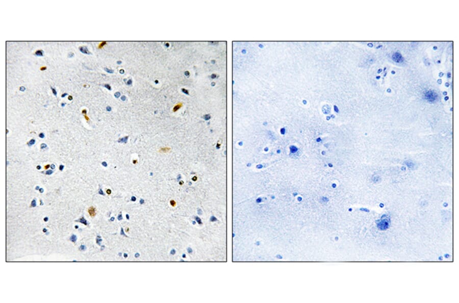 Immunohistochemistry - Anti-DIL-2 Antibody (C11884) - Antibodies.com