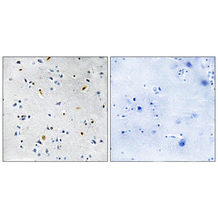 Immunohistochemistry - Anti-DIL-2 Antibody (C11884) - Antibodies.com