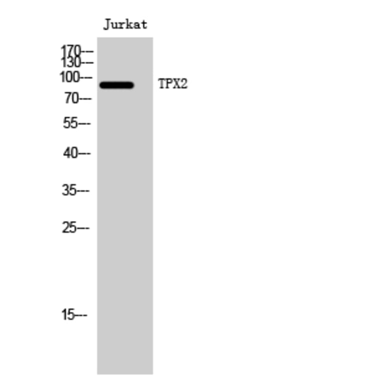 Western Blot - Anti-DIL-2 Antibody (C11884) - Antibodies.com