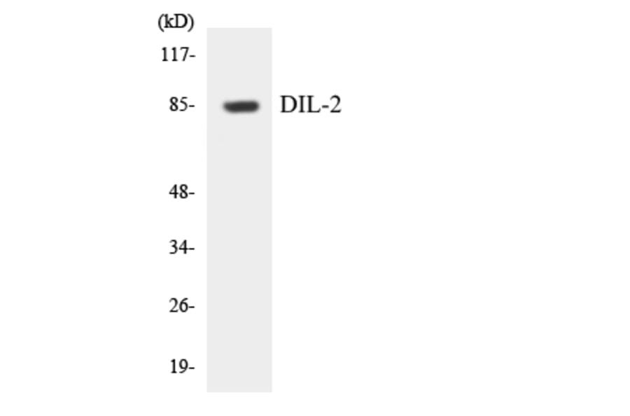 Western Blot - Anti-DIL-2 Antibody (R12-2699) - Antibodies.com