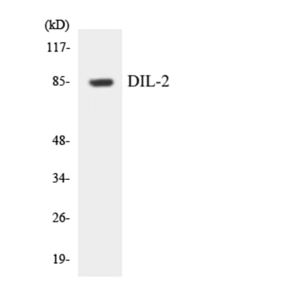 Western Blot - Anti-DIL-2 Antibody (R12-2699) - Antibodies.com