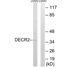 Western Blot - Anti-DECR2 Antibody (C17620) - Antibodies.com