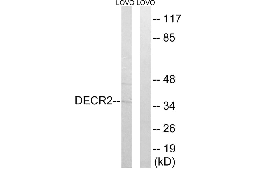 Western Blot - Anti-DECR2 Antibody (C17620) - Antibodies.com