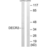 Western Blot - Anti-DECR2 Antibody (C17620) - Antibodies.com