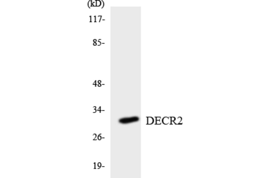 Western Blot - Anti-DECR2 Antibody (R12-2693) - Antibodies.com