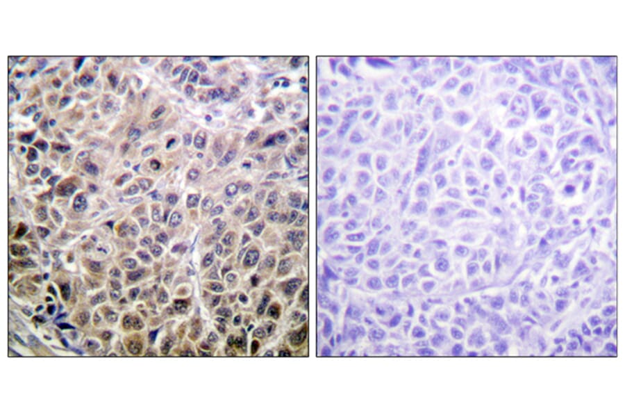 Immunohistochemistry - Anti-DAPK1 Antibody (B0898) - Antibodies.com