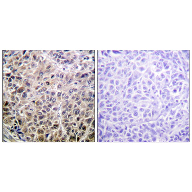 Immunohistochemistry - Anti-DAPK1 Antibody (B0898) - Antibodies.com