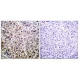 Immunohistochemistry - Anti-DAPK1 Antibody (B0898) - Antibodies.com