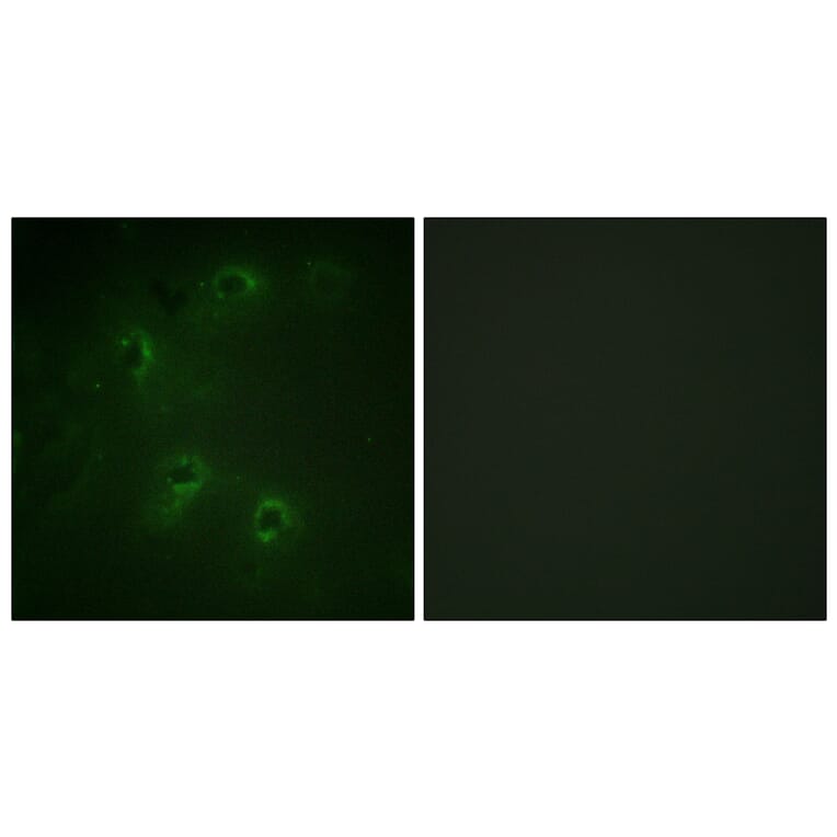 Immunofluorescence - Anti-DAPK1 Antibody (B0898) - Antibodies.com