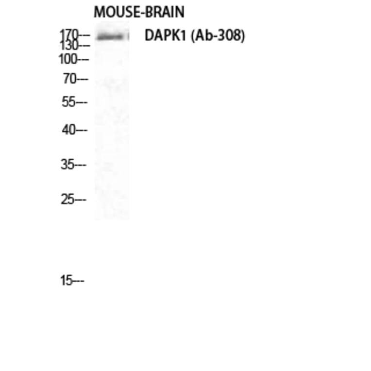 Western Blot - Anti-DAPK1 Antibody (B0898) - Antibodies.com