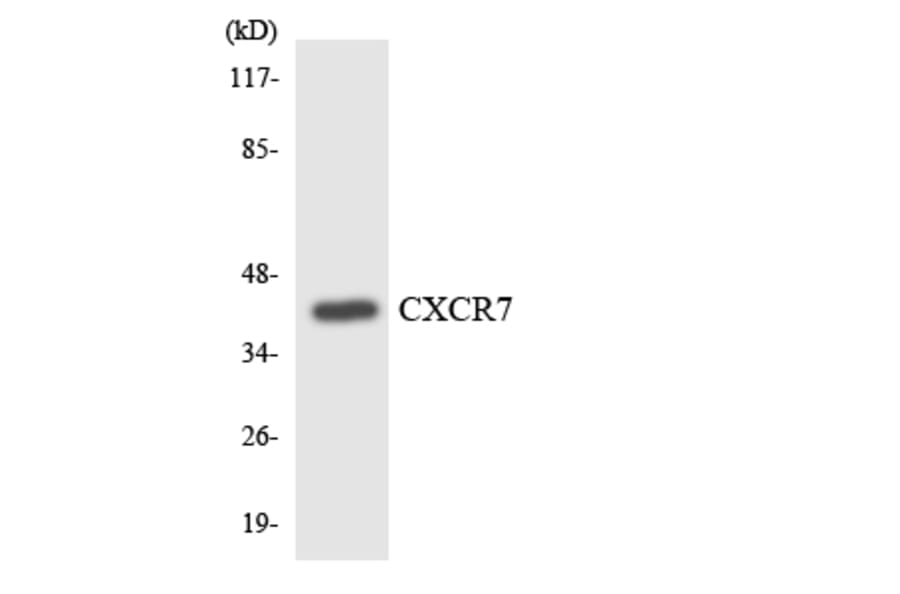 Western Blot - Anti-CXCR7 Antibody (R12-2662) - Antibodies.com