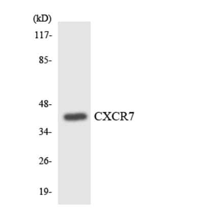 Western Blot - Anti-CXCR7 Antibody (R12-2662) - Antibodies.com