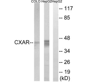 Western Blot - Anti-CXADR Antibody (C15257) - Antibodies.com