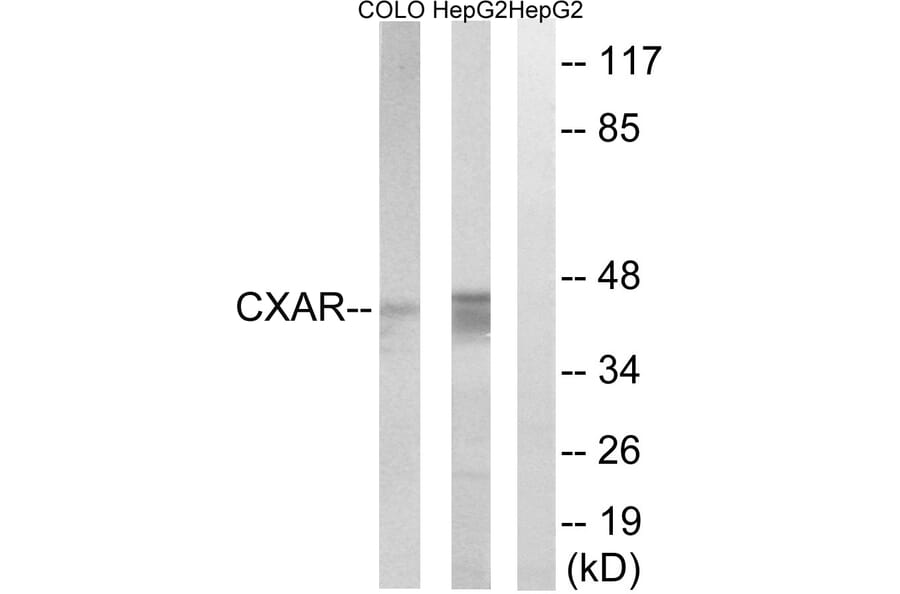 Western Blot - Anti-CXADR Antibody (C15257) - Antibodies.com