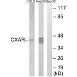 Western Blot - Anti-CXADR Antibody (C15257) - Antibodies.com
