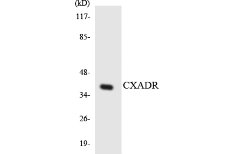 Western Blot - Anti-CXADR Antibody (R12-2661) - Antibodies.com
