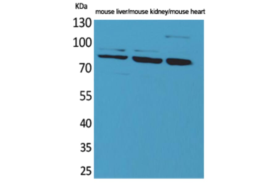 Western Blot - Anti-CUL4B Antibody (C30113) - Antibodies.com