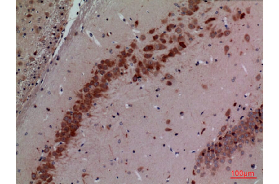 Immunohistochemistry - Anti-CUL4B Antibody (C30113) - Antibodies.com