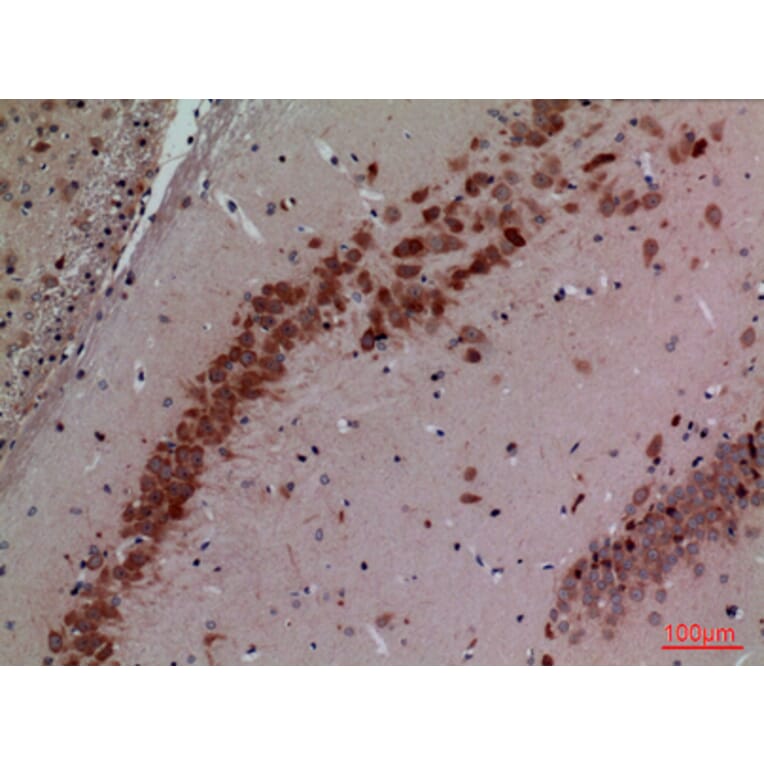 Immunohistochemistry - Anti-CUL4B Antibody (C30113) - Antibodies.com