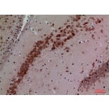 Immunohistochemistry - Anti-CUL4B Antibody (C30113) - Antibodies.com