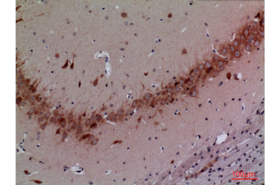 Immunohistochemistry - Anti-CUL4B Antibody (C30113) - Antibodies.com