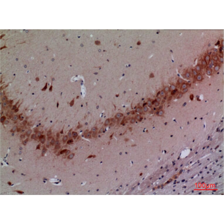 Immunohistochemistry - Anti-CUL4B Antibody (C30113) - Antibodies.com