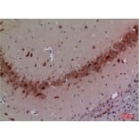 Immunohistochemistry - Anti-CUL4B Antibody (C30113) - Antibodies.com