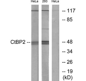 Western Blot - Anti-CtBP2 Antibody (C10751) - Antibodies.com