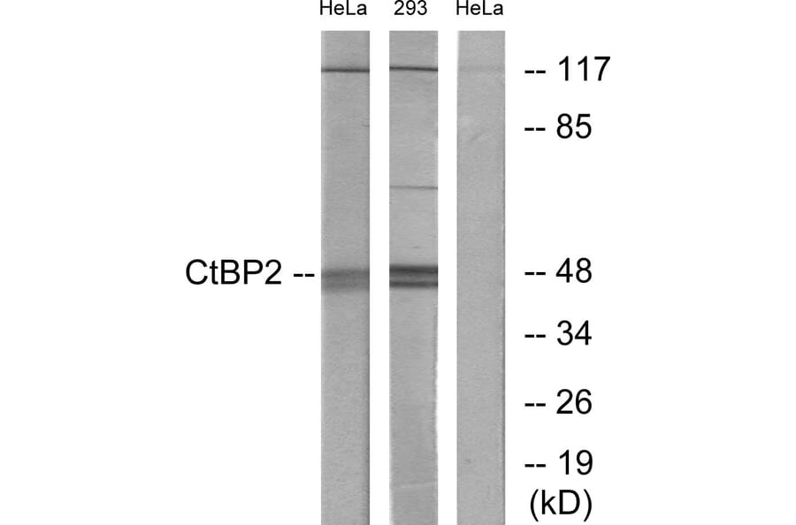 Western Blot - Anti-CtBP2 Antibody (C10751) - Antibodies.com