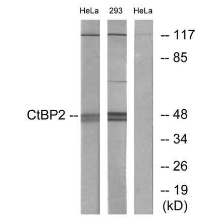Western Blot - Anti-CtBP2 Antibody (C10751) - Antibodies.com